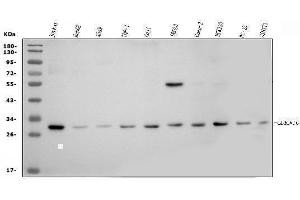 Western blot analysis of p57 Kip2/CDKN1C using anti-p57 Kip2/CDKN1C antibody (ABIN7603232).