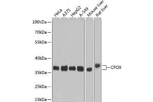Western blot analysis of extracts of various cell lines using CPOX Polyclonal Antibody at dilution of 1:1000. (CPOX Antikörper)