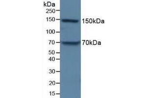 Detection of APOB in Porcine Liver Tissue using Polyclonal Antibody to Apolipoprotein B (APOB) (APOB Antikörper  (AA 3365-3548))