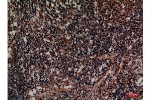 Immunohistochemistry (IHC) analysis of paraffin-embedded Human Lymph, antibody was diluted at 1:100.