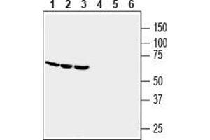 Western blot analysis of human THP-1 monocytic leukemia (lanes 1 and 4), human HL-60 promyelocytic leukemia (lanes 2 and 5) and human U-87 MG glioblastoma (lanes 3 and 6) cell line lysates: - 1-3. (GPR84 Antikörper  (2nd Extracellular Loop))