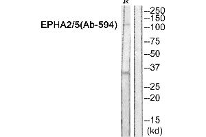 Western blot analysis of extracts from JK cells, using EPHA2/5 (Ab-594) Antibody.