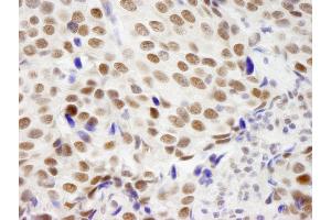 Immunohistochemistry (IHC) image for anti-Zinc Finger Protein 261 (ZMYM3) (AA 250-300) antibody (ABIN7448881)