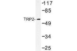 Image no. 1 for anti-Dopachrome Tautomerase (DCT) antibody (ABIN317917) (DCT Antikörper)