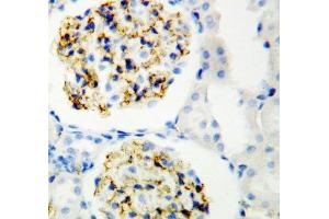 IHC-P: CD34 antibody testing of rat kidney (CD34 Antikörper  (C-Term))