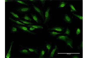 Immunofluorescence (IF) image for anti-Zinc Finger CCHC-Type and RNA Binding Motif 1 (ZCRB1) (AA 1-217) antibody (ABIN949754)