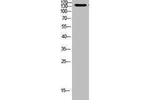 Western Blot analysis of 293t cells using Antibody diluted at 1000 (MIB1 Antikörper  (AA 901-950))