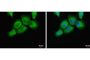 ICC/IF Image uPAR antibody detects uPAR protein at cytoplasm by immunofluorescent analysis. (PLAUR Antikörper)