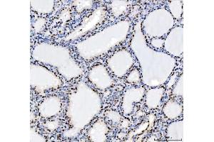 IHC analysis of HDAC2 using anti-HDAC2 antibody (ABIN7601564). (HDAC2 Antikörper  (AA 387-488))