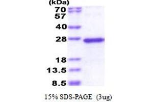 SDS-PAGE (SDS) image for TGFB-Induced Factor Homeobox 2-Like, Y-Linked (TGIF2LY) (AA 1-185) protein (His tag) (ABIN5853539) (TGIF2LY Protein (AA 1-185) (His tag))
