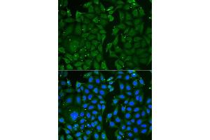 Immunofluorescence analysis of U2OS cells using TKT antibody. (TKT Antikörper  (AA 1-280))