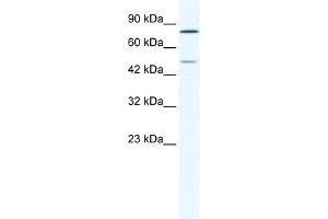 Western Blot showing ZNF12 antibody used at a concentration of 1-2 ug/ml to detect its target protein. (ZNF12 Antikörper  (N-Term))