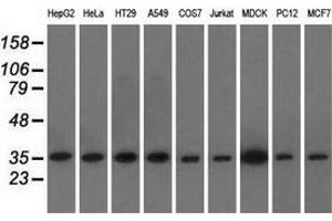 Western blot analysis of extracts (35 µg) from 9 different cell lines by using anti-EIF2S1 monoclonal antibody.