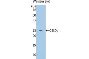 Western blot analysis of the recombinant protein. (CD8 alpha Antikörper  (AA 26-236))