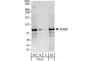 Western Blotting (WB) image for anti-Numb Homolog (NUMB) (AA 375-425) antibody (ABIN7451903)