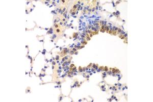Immunohistochemistry of paraffin-embedded mouse lung using NFKB1 antibody (ABIN5974018) at dilution of 1/100 (40x lens). (NFKB1 Antikörper)