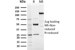 SDS-PAGE Analysis Purified Langerin Recombinant Rabbit Monoclonal Antibody (LGRN/3136R).