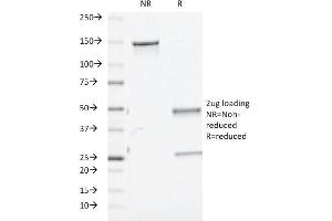 SDS-PAGE Analysis Purified TGF beta Mouse Monoclonal Antibody (TGFB/510). (TGF-beta Antikörper)