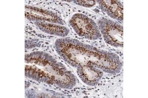 Immunohistochemical staining of human stomach with BEGAIN polyclonal antibody  shows strong cytoplasmic positivity in granular pattern in glandular cells at 1:200-1:500 dilution. (BEGAIN Antikörper)