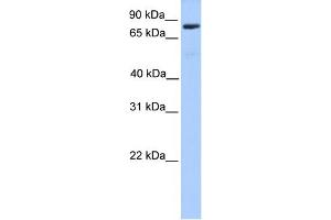 WB Suggested Anti-C12orf40 Antibody Titration: 0. (C12orf40 Antikörper  (N-Term))