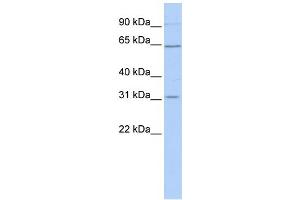 WB Suggested Anti-SLC27A2 Antibody Titration:  1 ug/ml  Positive Control:  Hela cell lysate