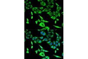 Immunofluorescence analysis of U2OS cells using HADHA antibody (ABIN5973083).