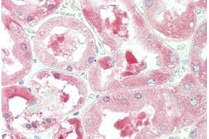 Human Kidney: Formalin-Fixed, Paraffin-Embedded (FFPE)