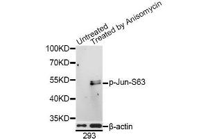 Western blot analysis of extracts of 293 cells, using Phospho-Jun-S63 antibody (ABIN5969905) at 1/1000 dilution. (C-JUN Antikörper  (pSer63))