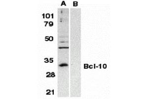 Western Blotting (WB) image for anti-B-Cell CLL/lymphoma 10 (BCL10) (N-Term) antibody (ABIN1031265) (BCL10 Antikörper  (N-Term))