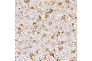 Immunohistochemistry of paraffin-embedded rat brain using USO1 Rabbit mAb (ABIN7271234) at dilution of 1:25 (40x lens). (USO1 Antikörper)