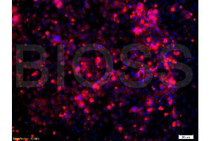 Immunofluorescence (IF) image for anti-Nuclear Receptor Subfamily 3, Group C, Member 1 (Glucocorticoid Receptor) (NR3C1) (AA 231-320) antibody (ABIN726875)