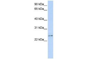 RCAN3 antibody used at 1 ug/ml to detect target protein. (RCAN3 Antikörper  (Middle Region))