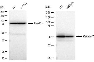 Western blotting analysis using Keratin 7 antibody (ABIN7799186).