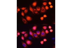 Immunofluorescence analysis of HeLa cells using HRAS antibody (ABIN6130448, ABIN6141983, ABIN6141985 and ABIN6215813) at dilution of 1:100 (40x lens). (HRAS Antikörper  (AA 1-189))