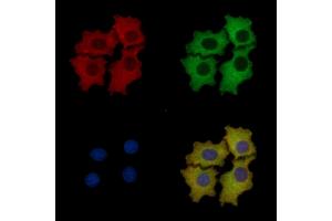 ALDOA Mouse Monoclonal Antibody staining HepG2 cells by IF/ICC. (ALDOA Antikörper  (N-Term))
