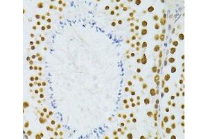 Immunohistochemistry (Paraffin-embedded Sections) (IHC (p)) image for anti-THO Complex 4 (THOC4) antibody (ABIN7261904)