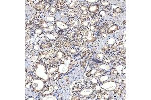 IHC analysis of Syntenin 2/SDCBP2 using anti-Syntenin 2/SDCBP2 antibody (ABIN7600017). (SDCBP2 Antikörper  (AA 14-292))