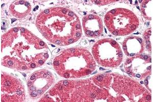 Human Kidney (formalin-fixed, paraffin-embedded) stained with AKR1A1 antibody ABIN351467 at 2. (AKR1A1 Antikörper  (AA 313-325))