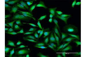 Immunofluorescence of purified MaxPab antibody to IFIT2 on HeLa cell. (IFIT2 Antikörper  (AA 1-484))
