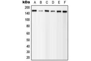 Western blot analysis of PLC gamma 1 (pY1253) expression in MCF7 EGF-treated (A), A431 (B), mouse brain (C), mouse liver (D), H9C2 EGF-treated (E) whole cell lysates. (Phospholipase C gamma 1 Antikörper  (C-Term, pTyr1253))