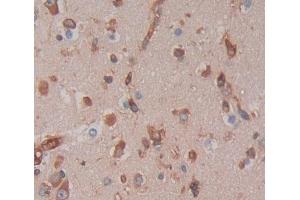 IHC-P analysis of brain tissue, with DAB staining. (GTF3A Antikörper  (AA 71-365))