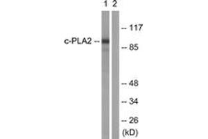 Western blot analysis of extracts from HeLa cells, treated with TNF-a 20ng/ml 30', using c-PLA2 (Ab-505) Antibody. (C-PLA2 (AA 471-520) Antikörper)
