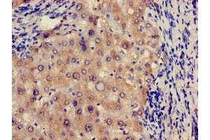 Immunohistochemistry of paraffin-embedded human liver tissue using ABIN7172206 at dilution of 1:100 (FUCA1 Antikörper  (AA 32-158))