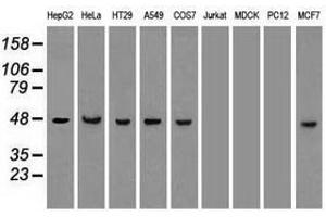 Image no. 3 for anti-Keratin 18 (KRT18) (AA 69-372) antibody (ABIN1491638) (Cytokeratin 18 Antikörper  (AA 69-372))