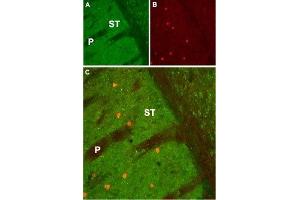 Expression of Muscarinic acetylcholine receptor M1 in mouse striatum - Immunohistochemical staining of mouse striatum (ST) using Anti-CHRM1 Antibody (ABIN7043060, ABIN7044580 and ABIN7044581). (CHRM1 Antikörper  (AA 227-353))