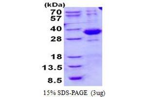 Image no. 1 for SplA/ryanodine Receptor Domain and SOCS Box Containing 2 (SPSB2) (AA 1-263) protein (His tag) (ABIN1098440)