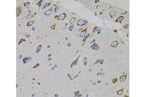 Immunohistochemistry of paraffin-embedded Rat brain using VEGFC Polyclonal Antibody (VEGFC Antikörper)