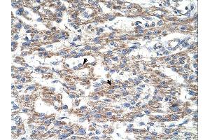 DUT antibody was used for immunohistochemistry at a concentration of 4-8 ug/ml. (Deoxyuridine Triphosphatase (DUT) (N-Term) Antikörper)