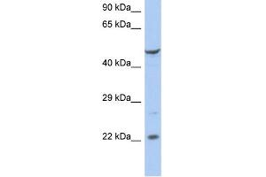 WB Suggested Anti-FLJ44894 Antibody Titration:  0. (FLJ44894 Antikörper  (N-Term))
