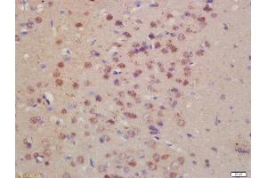 Formalin-fixed and paraffin embedded rat brain labeled with Rabbit Anti- Pro-Neuregulin Polyclonal Antibody, Unconjugated  at 1:200 followed by conjugation to the secondary antibody and DAB staining (Neuregulin 1 Antikörper  (AA 221-320))